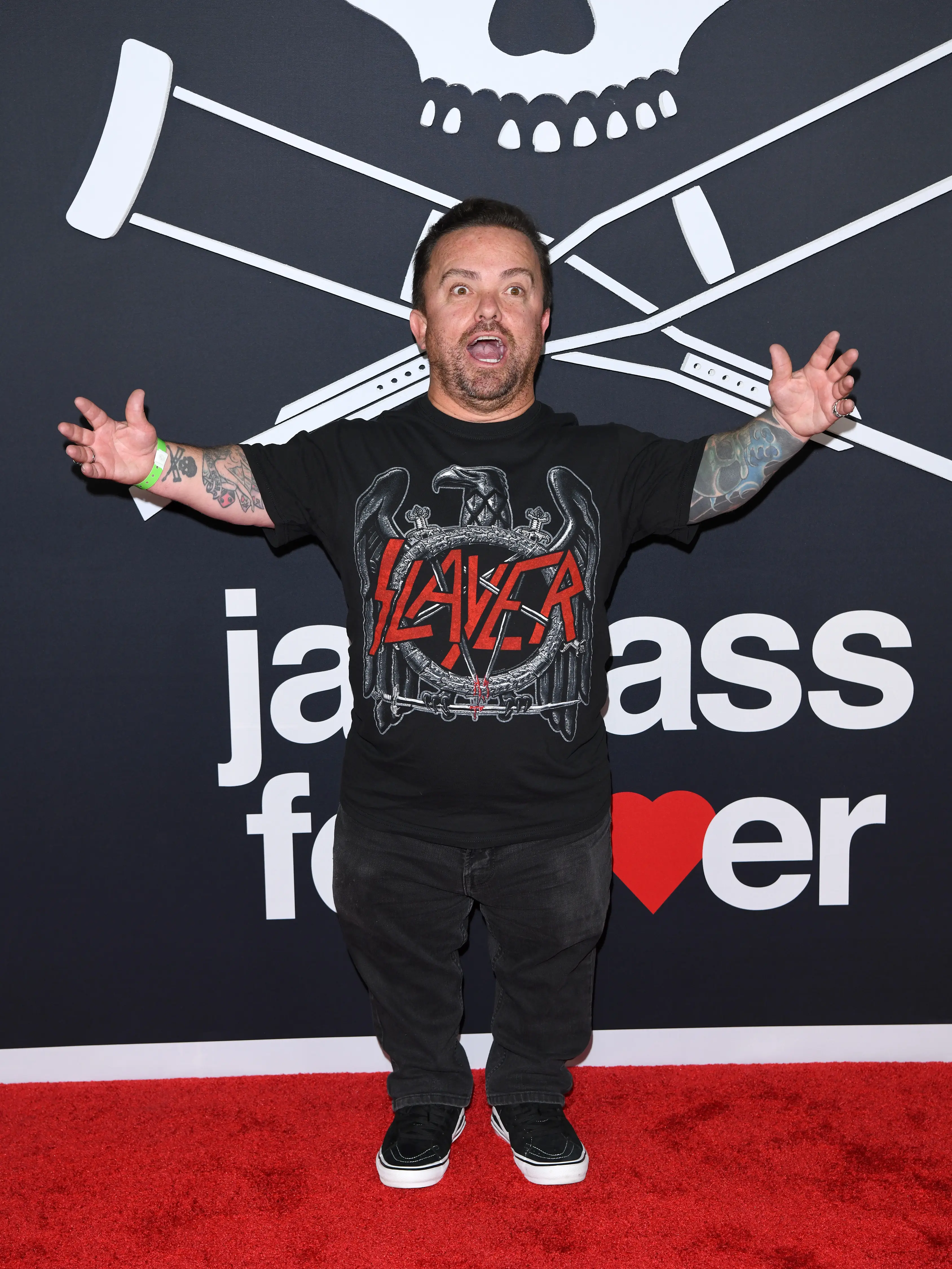 Wee Man has slammed the decision to cast Hugh Grant.