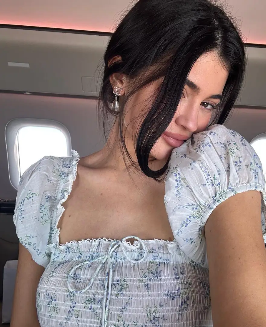 Kylie has denied having surgery to change her 'whole face'.