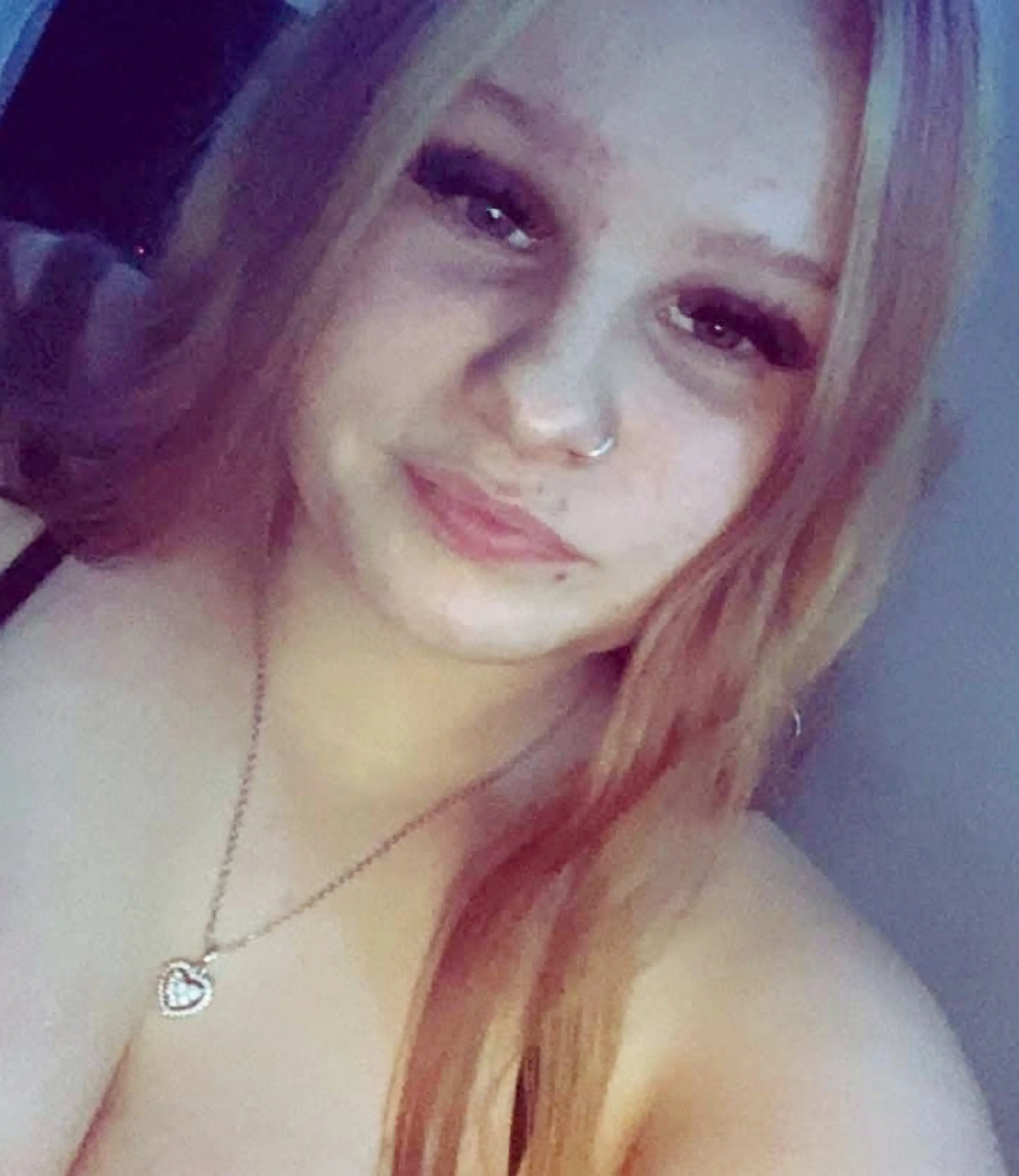 Shakira Gorman remains in hospital (SWNS)