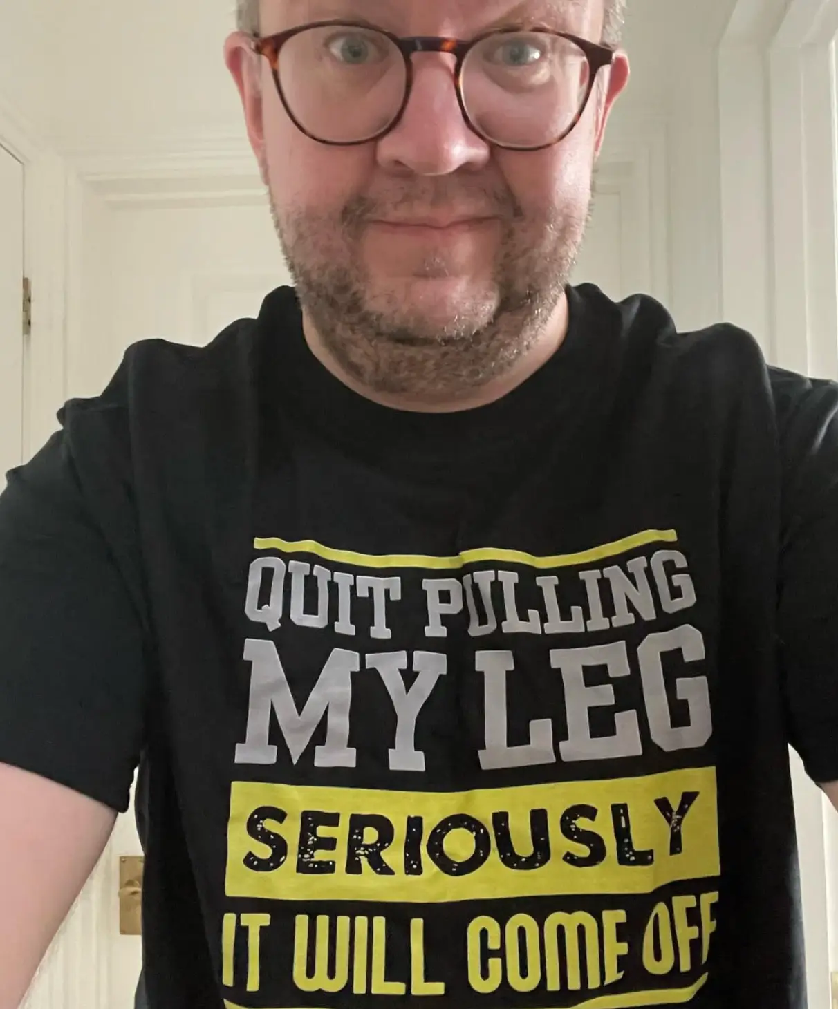 Hopper had his legs amputated from below the knee in 2019 (bionicsurgeon/Instagram)