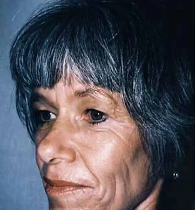 Gay Block at the age of 59 (Darrick E. Antell, M.D)