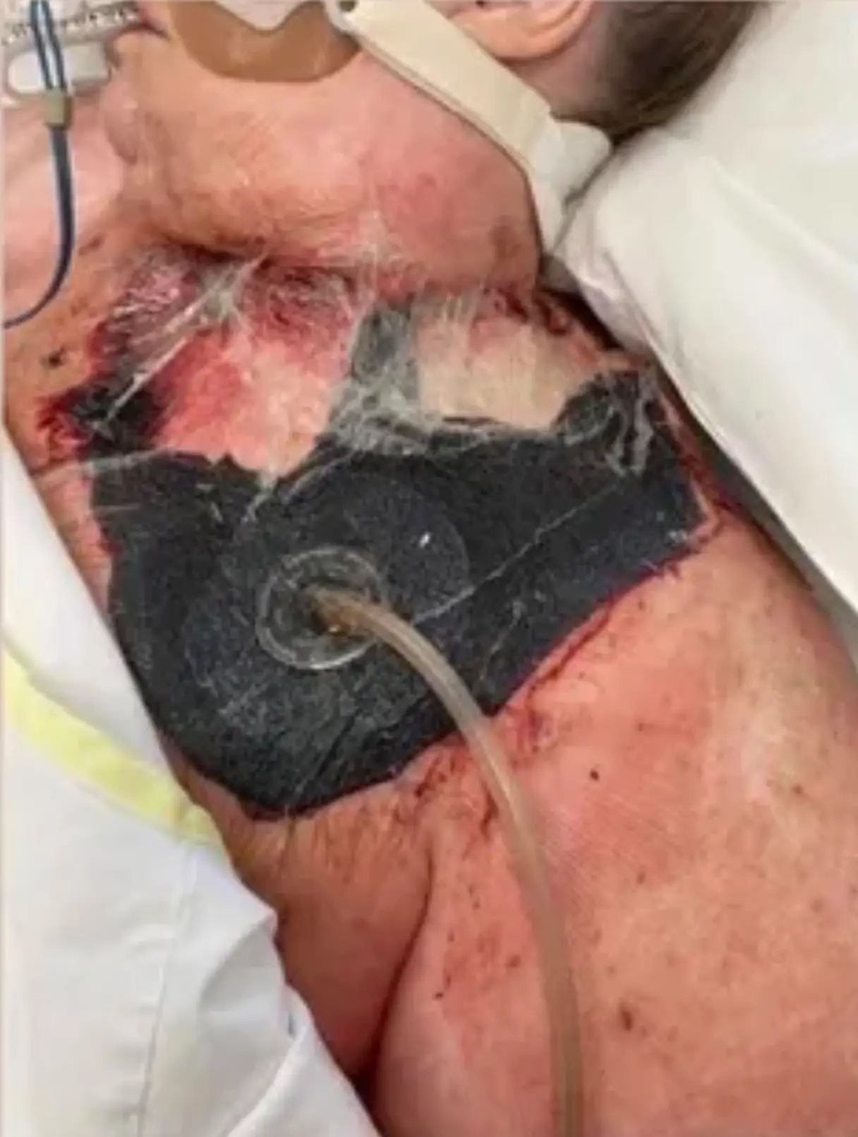 Her life ‘hung in the balance’.