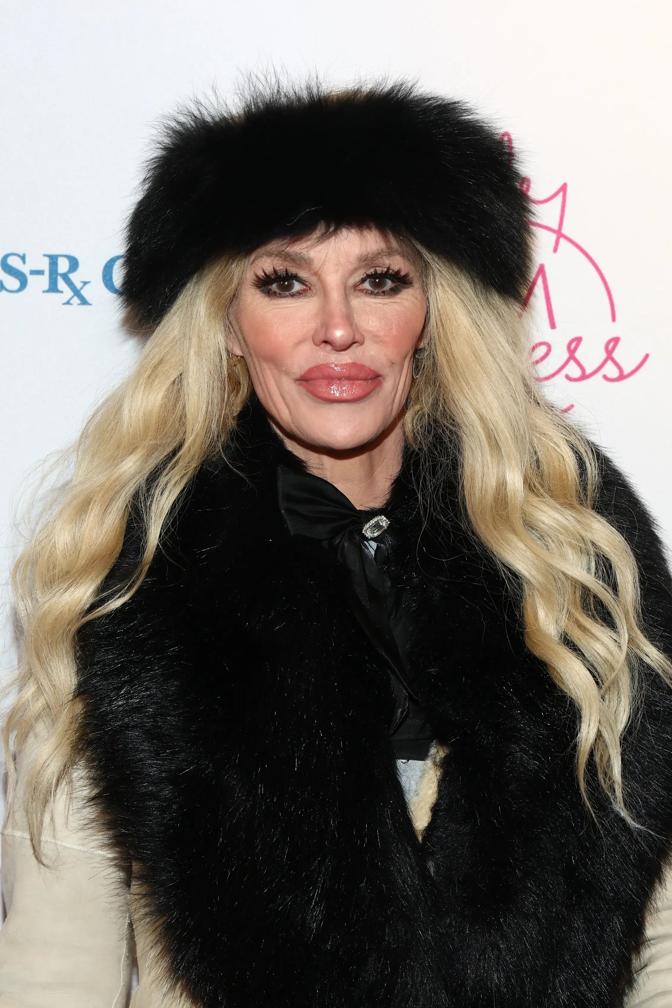 Brandi Glanville will have her 'face taken off' in a procedure (Tommaso Boddi/Getty Images for Rachel Strauss)