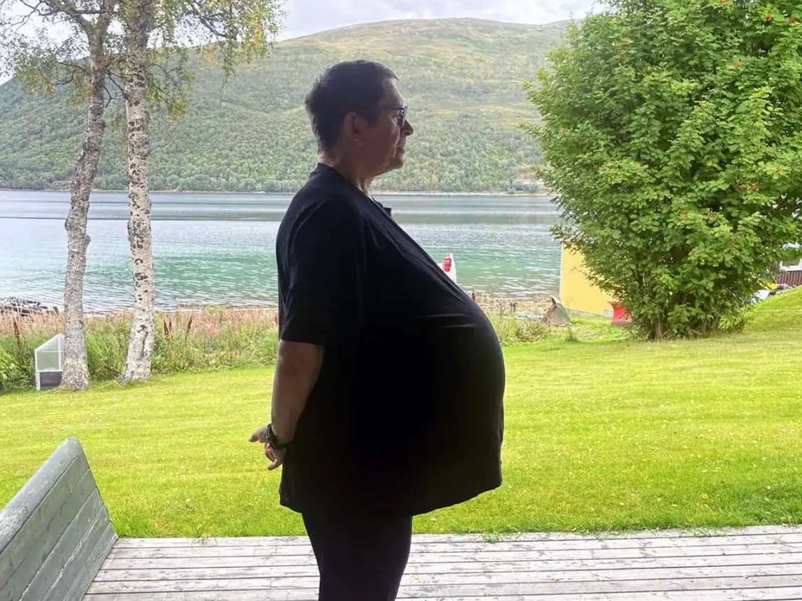 Doctors thought Thomas was simply overweight (NF/NewsX)