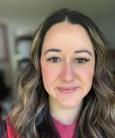 The woman says she still has problems with her eyesight (deborahcobb_ihp/Instagram)