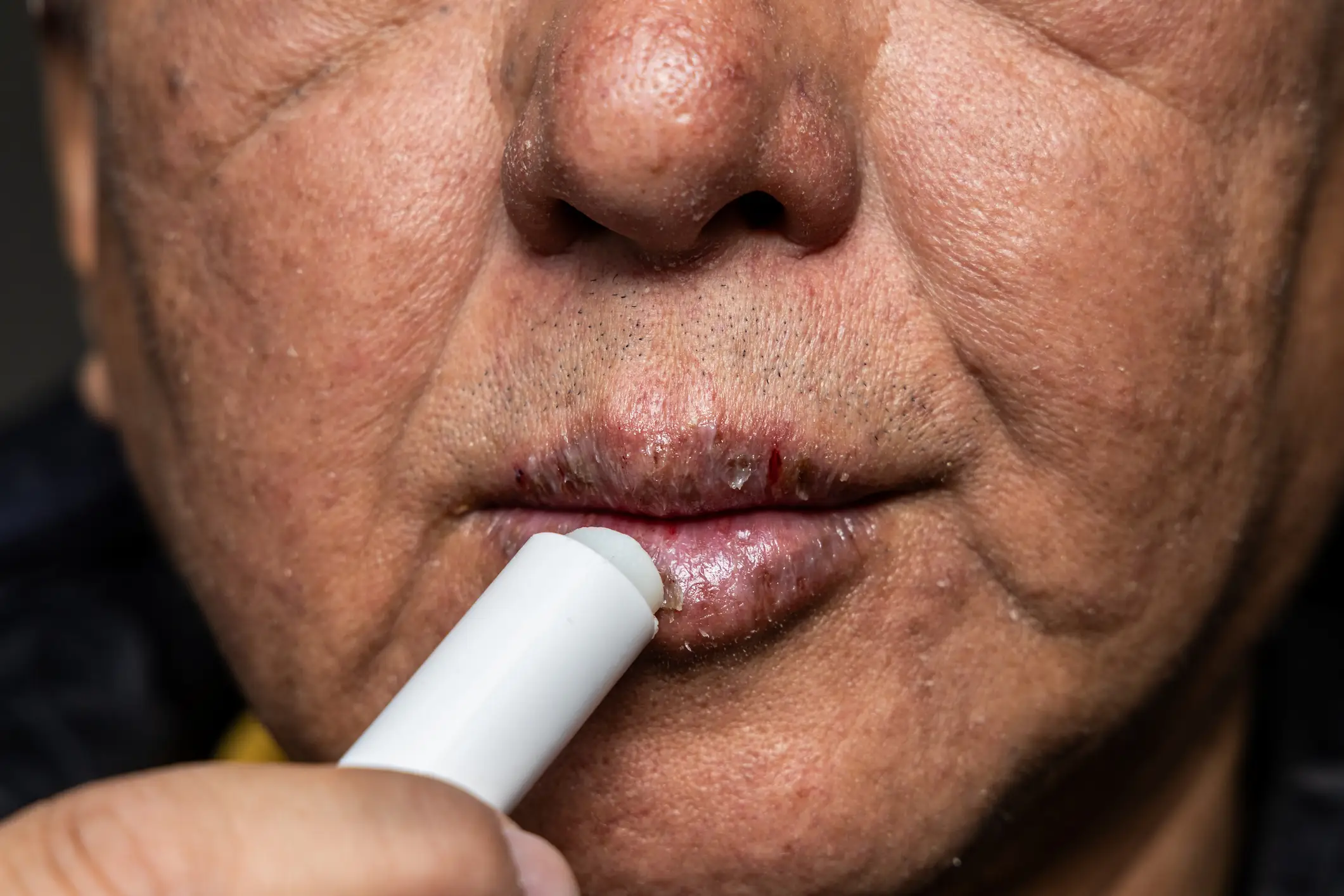 Your lips are likely to become dry if you're not drinking enough water (Getty Stock)