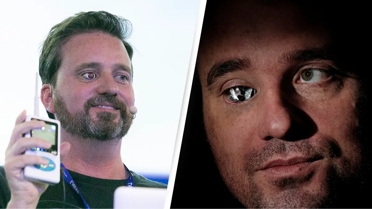 Man who lost his eye explains why he replaced it with a wireless camera