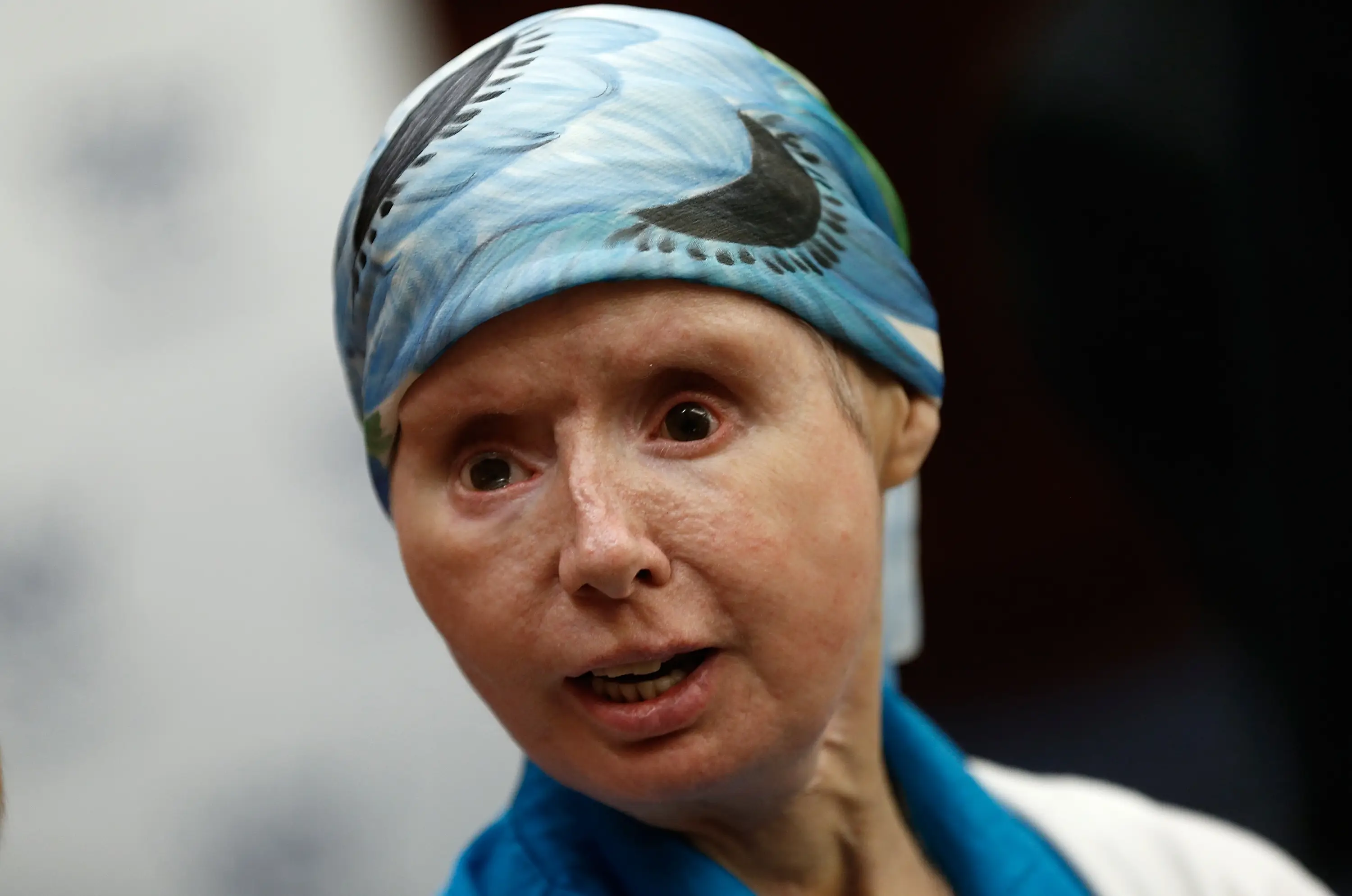 Charla Nash sustained life-changing injuries from the attack.