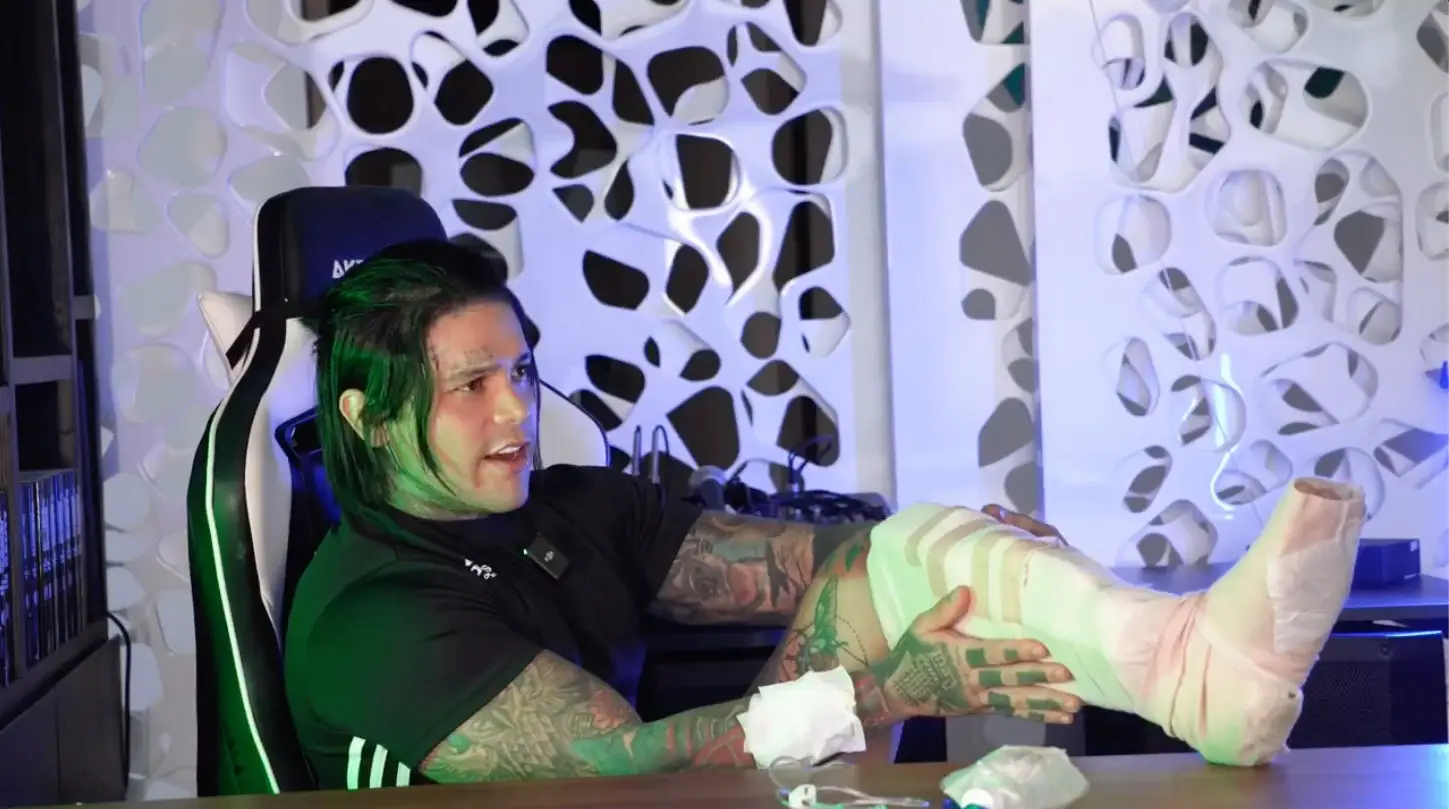 The influencer has been left in excruciating pain.