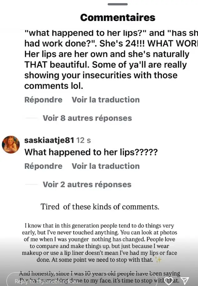 The model confirmed she'd not gone under the knife (Instagram/thylaneblondeau)