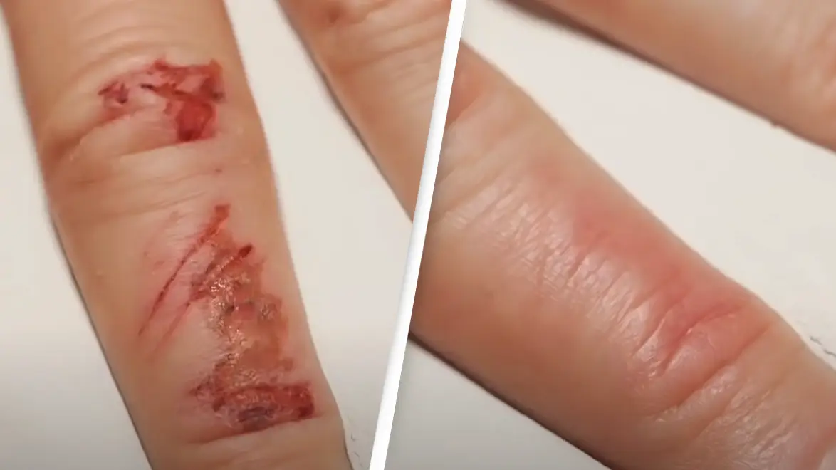'Fascinating' timelapse shows how a wound heals itself
