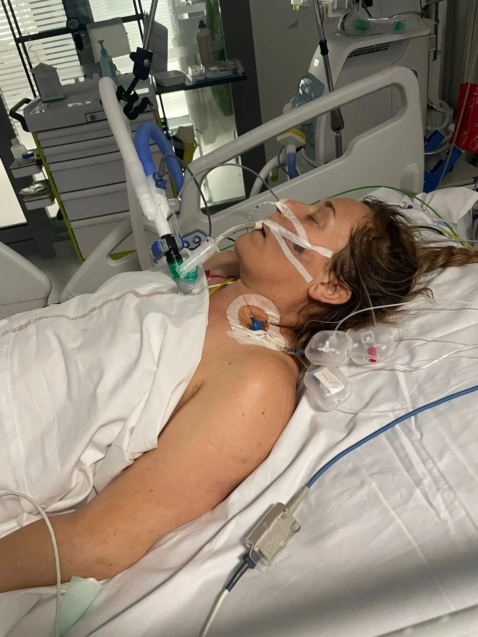 Friedel de Beer spent eight days in a coma (PA Real Life)