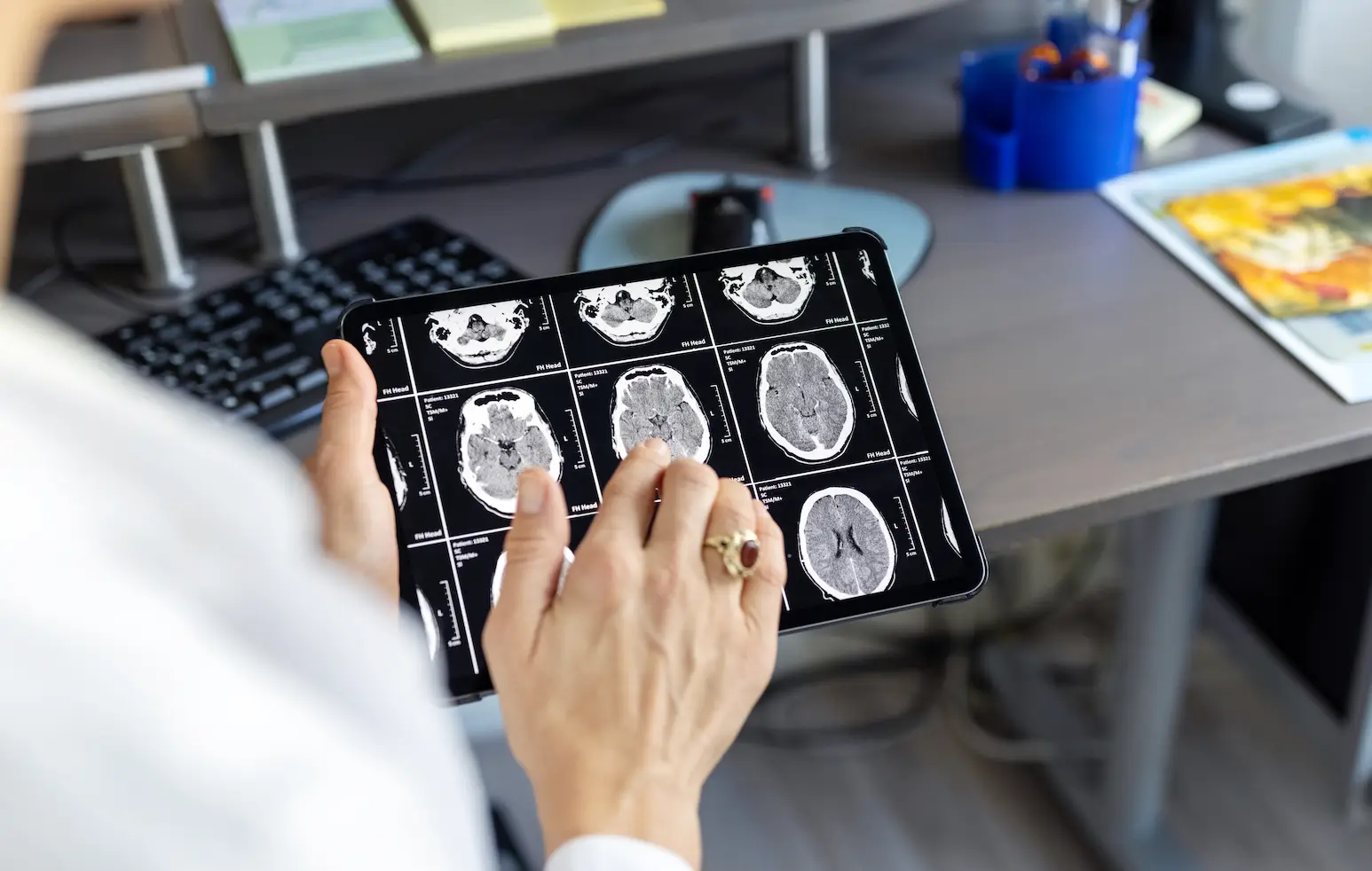 The study and trial focused on three patients with a recurrent type of brain tumor. (Getty Stock Images/ Luis Alvarez)
