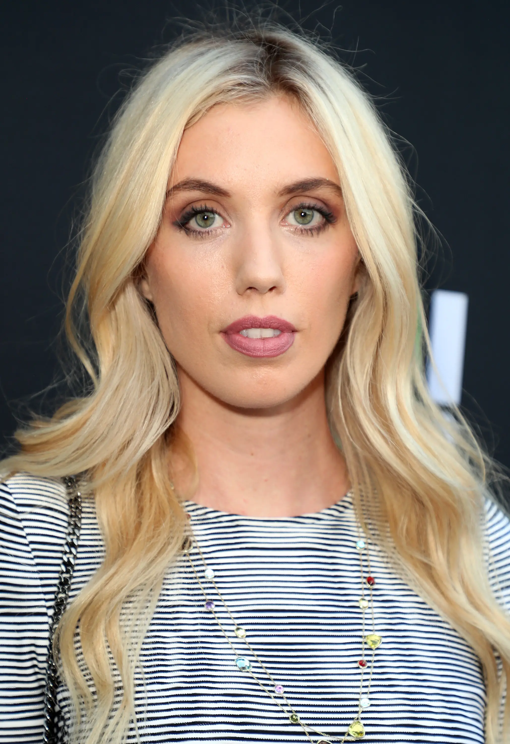 Clery was involved in a horrible freak accident (Chelsea Lauren/Variety/Penske Media via Getty Images)