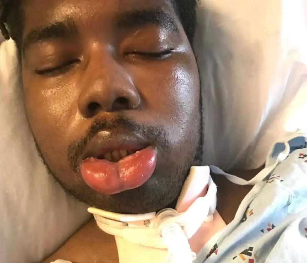 NJ remains in a vegetative state.