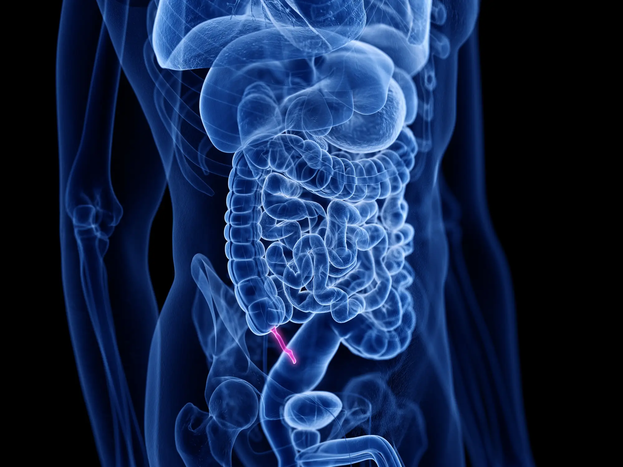 The appendix is located in the lower right of the abdomen, near the hip bone (Sebastian Kaulitzki/Science Photo Library/Getty Images)