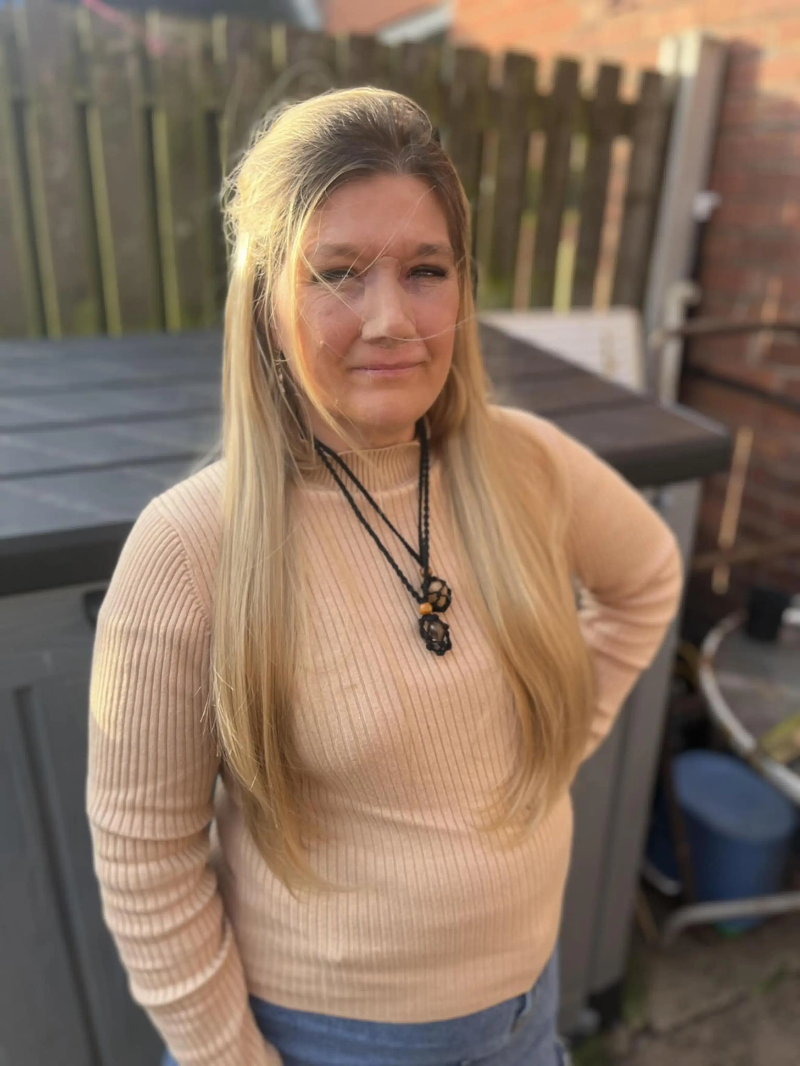 The mom now has a prosthetic nose (Kennedy News and Media)