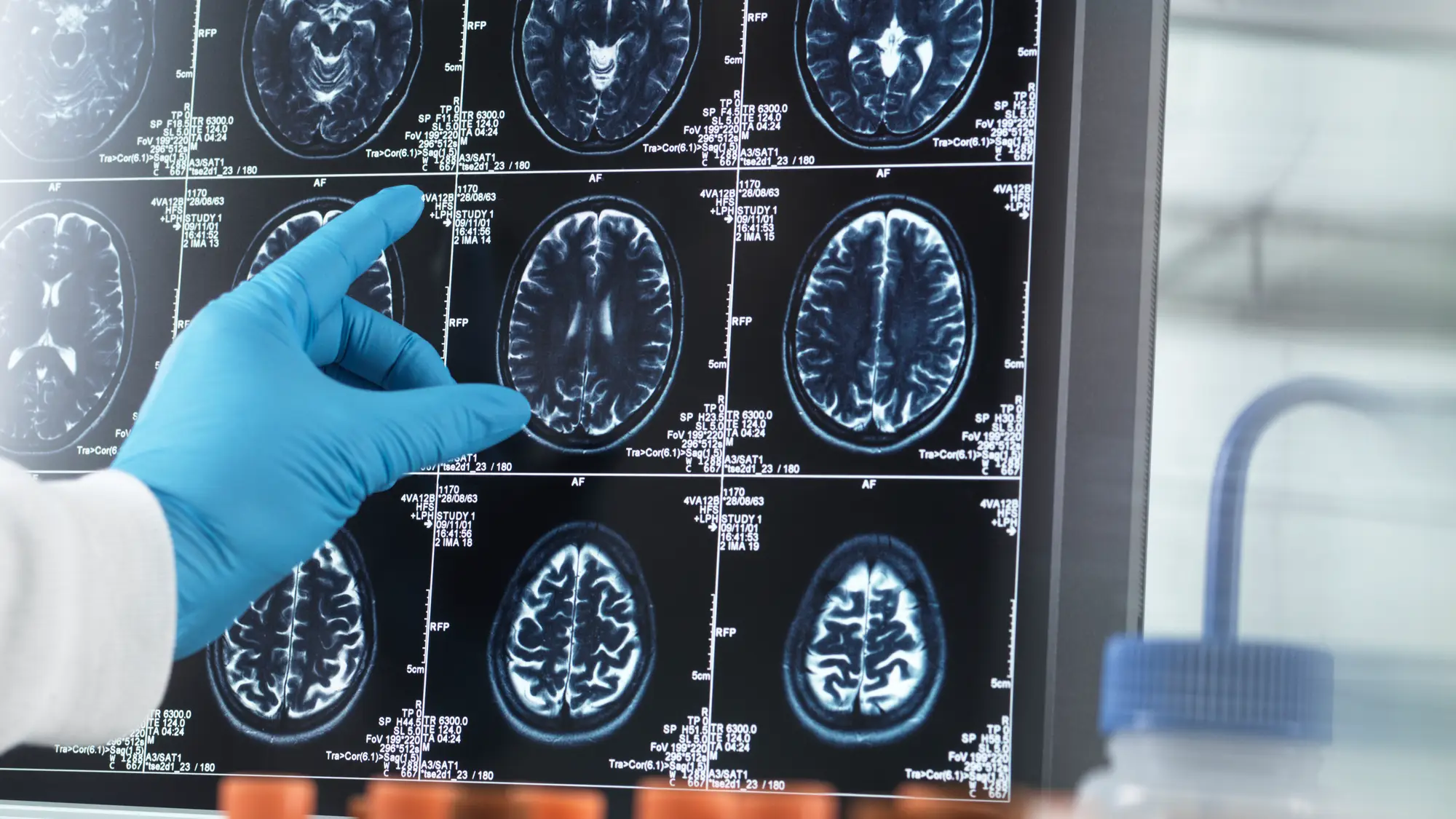 TEK IMAGE/SCIENCE PHOTO LIBRARY/Getty