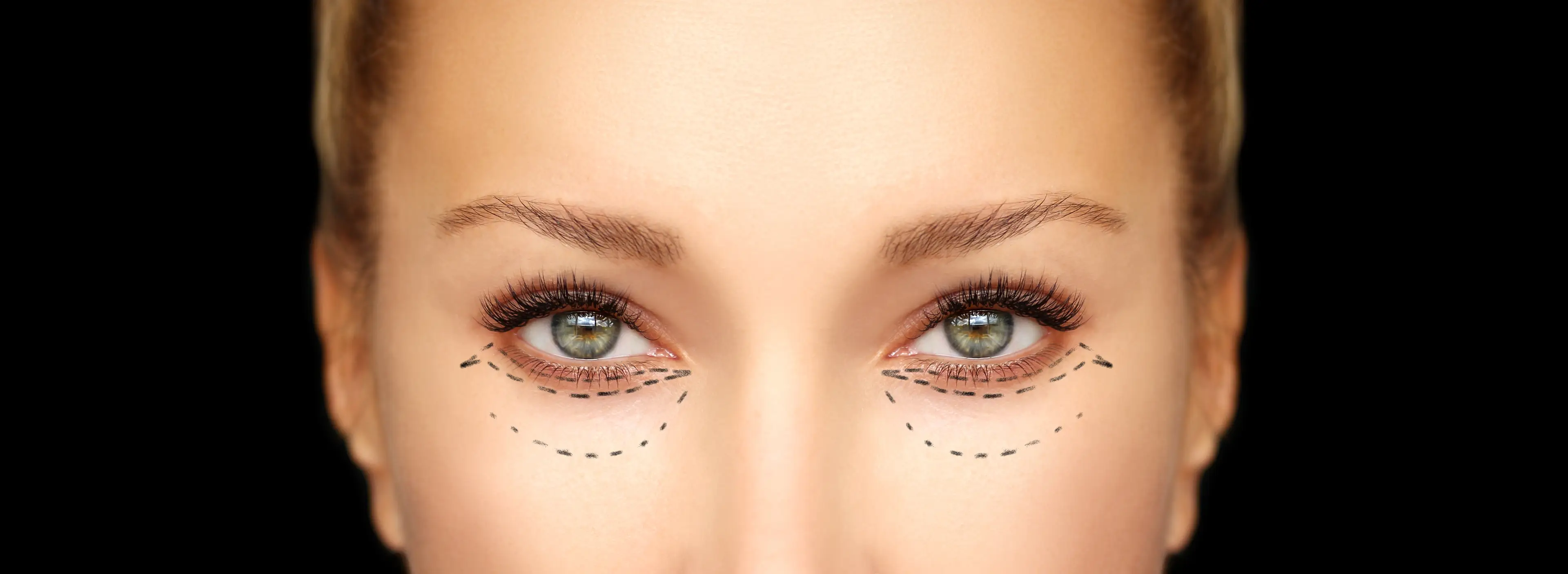 Canthoplasty, or Fox Eye, has been popularised by people wanting to look like celebs (Getty Stock Images)