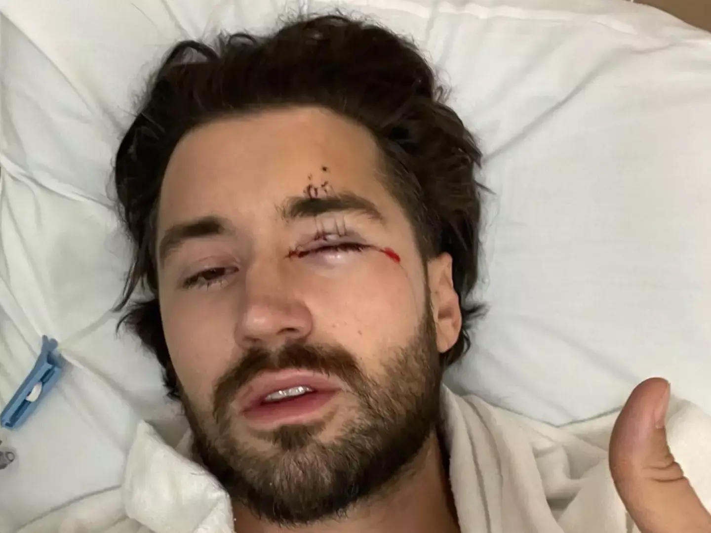 Witteck eventually sued Dobrik for $10 million but speaking on X, Witteck has said the truth still hasn’t been told and he intends to reveal it to the public. (Instagram/ @jeff)