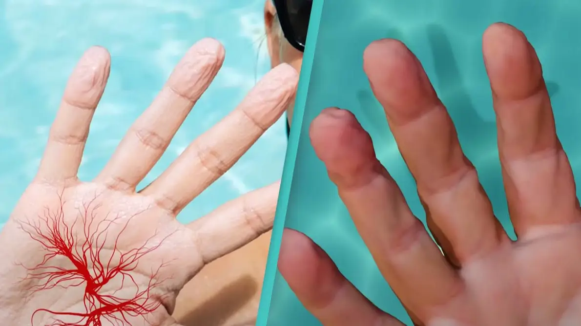 Bizarre simulation shows why fingers wrinkle when wet but it doesn't happen to everyone
