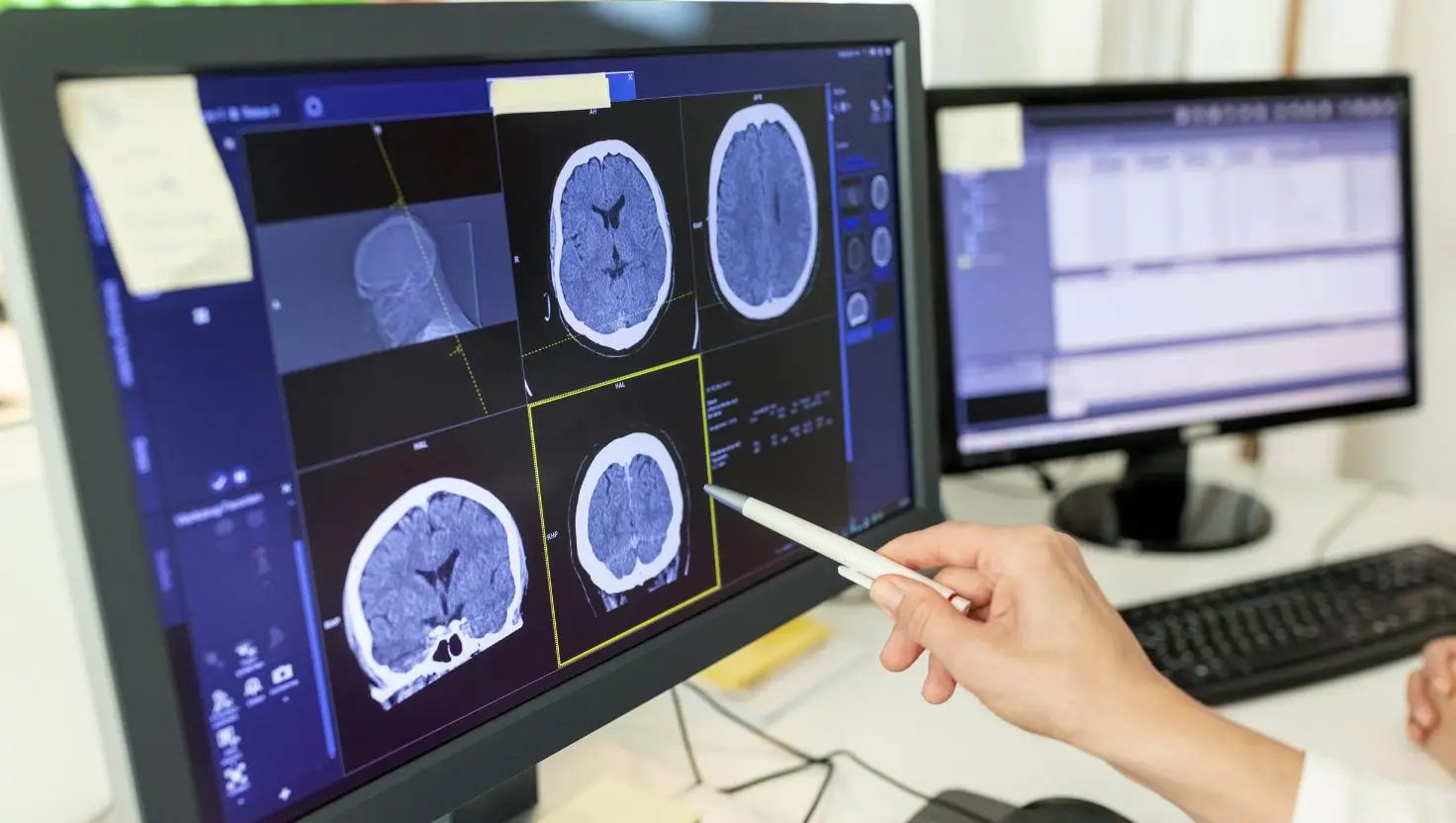 Experts in India have conducted a new supplement study and have shared the results (Getty Stock Image)