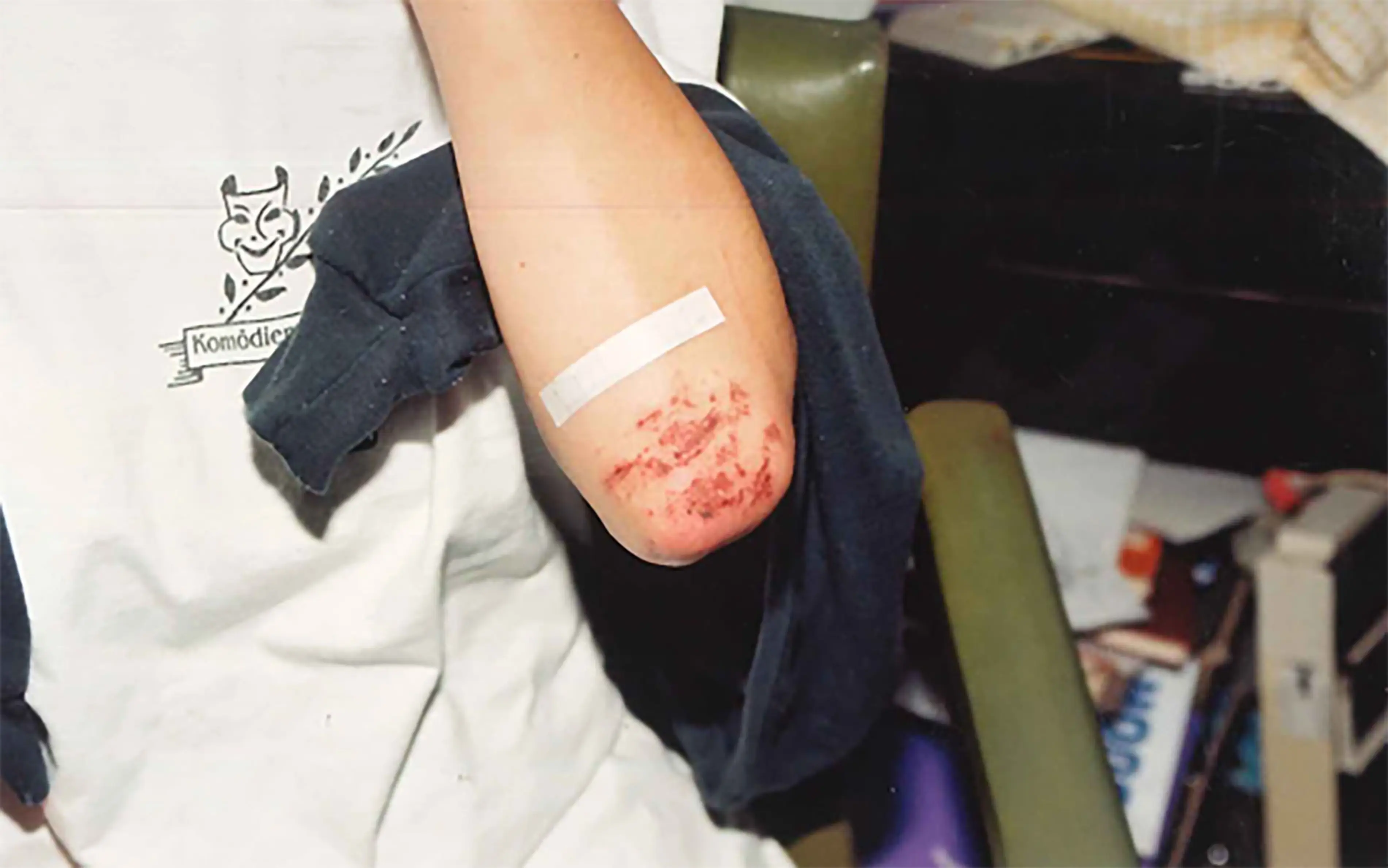 Northern Territory police have revealed images of cuts and grazes sustained by Lees during the attack (Northern Territory Police)