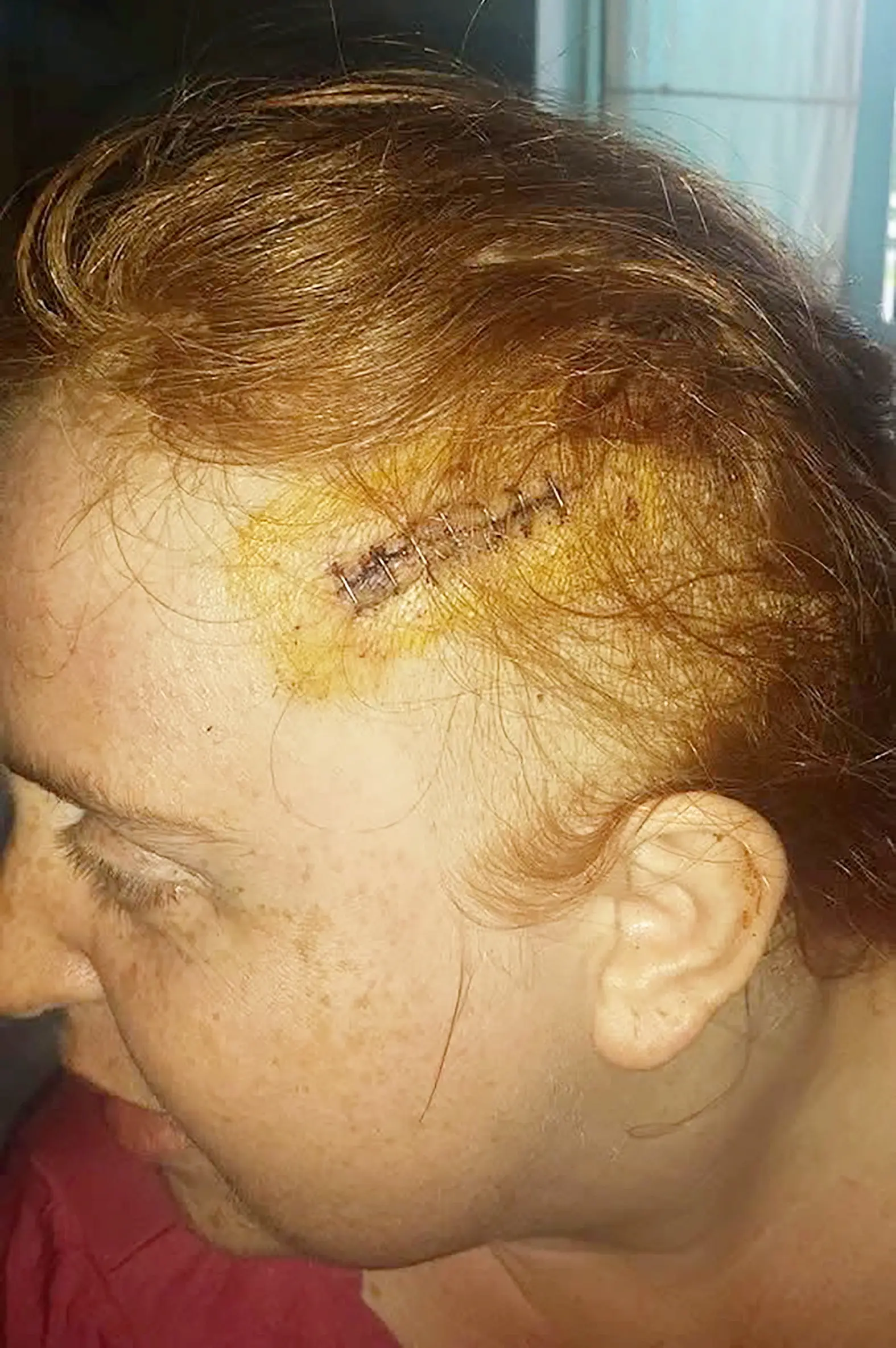 Samantha Smith was diagnosed with a brain tumor in 2014 (SWNS)