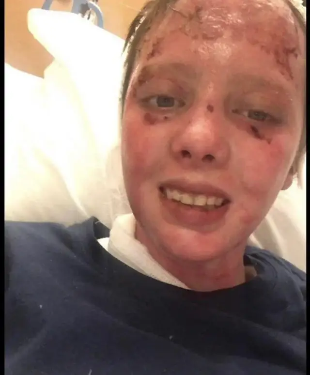 Abbey could be seen trying to smile through her ordeal (Reddit/abbeyiskewl2)