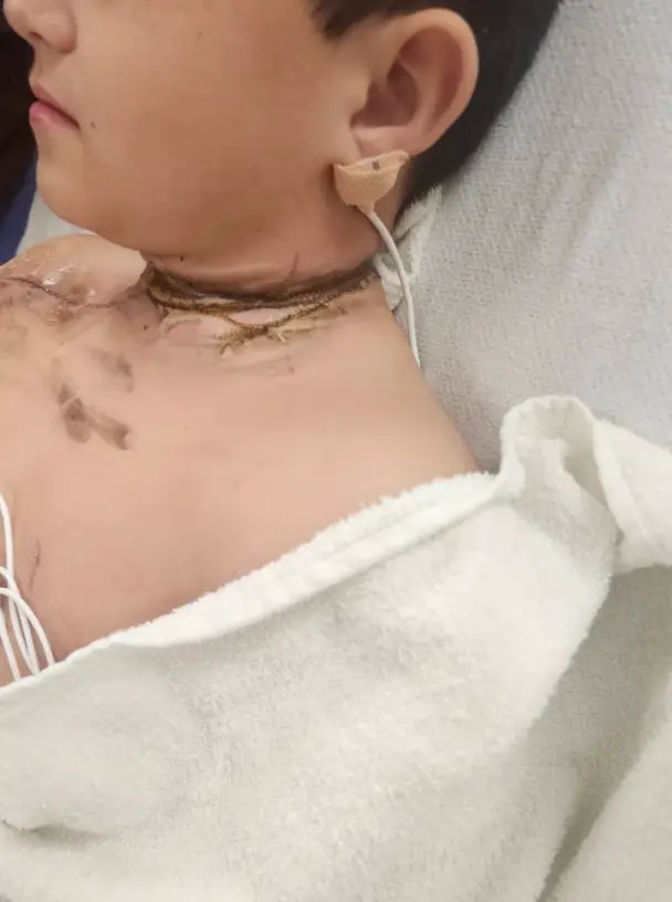 The boy had been wearing a necklace at the time of the scary ordeal (GoFundMe)