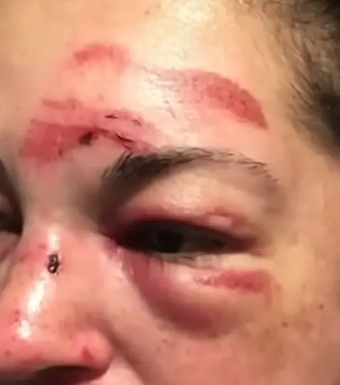 She says she's 'sad' that she can't do the things she used to love (NBCLA)