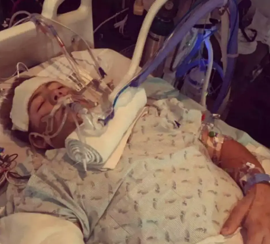 Loren seen after his accident (Instagram/@loren.schauers)