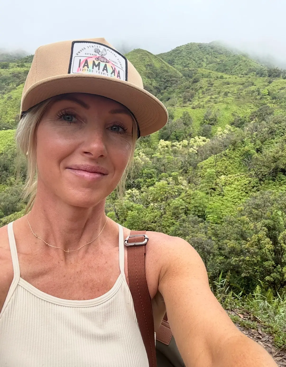 Jen Hauer had a bad reaction to Botox after just one injection (SWNS)