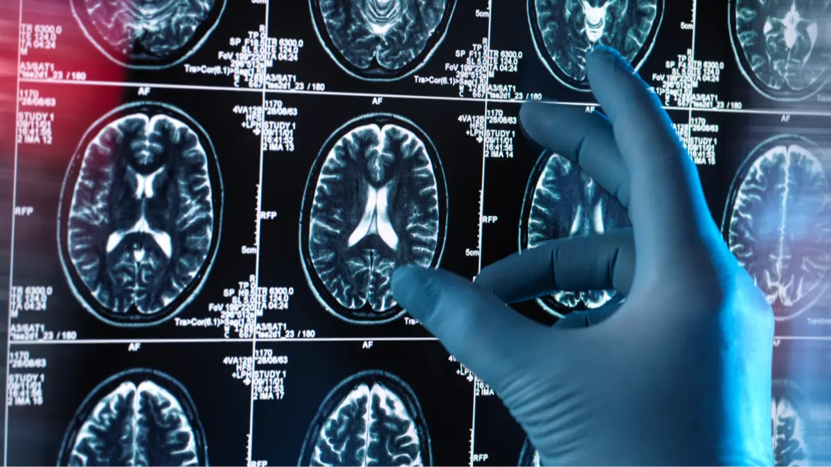 Getty Images/TEK IMAGE/SCIENCE PHOTO LIBRARY