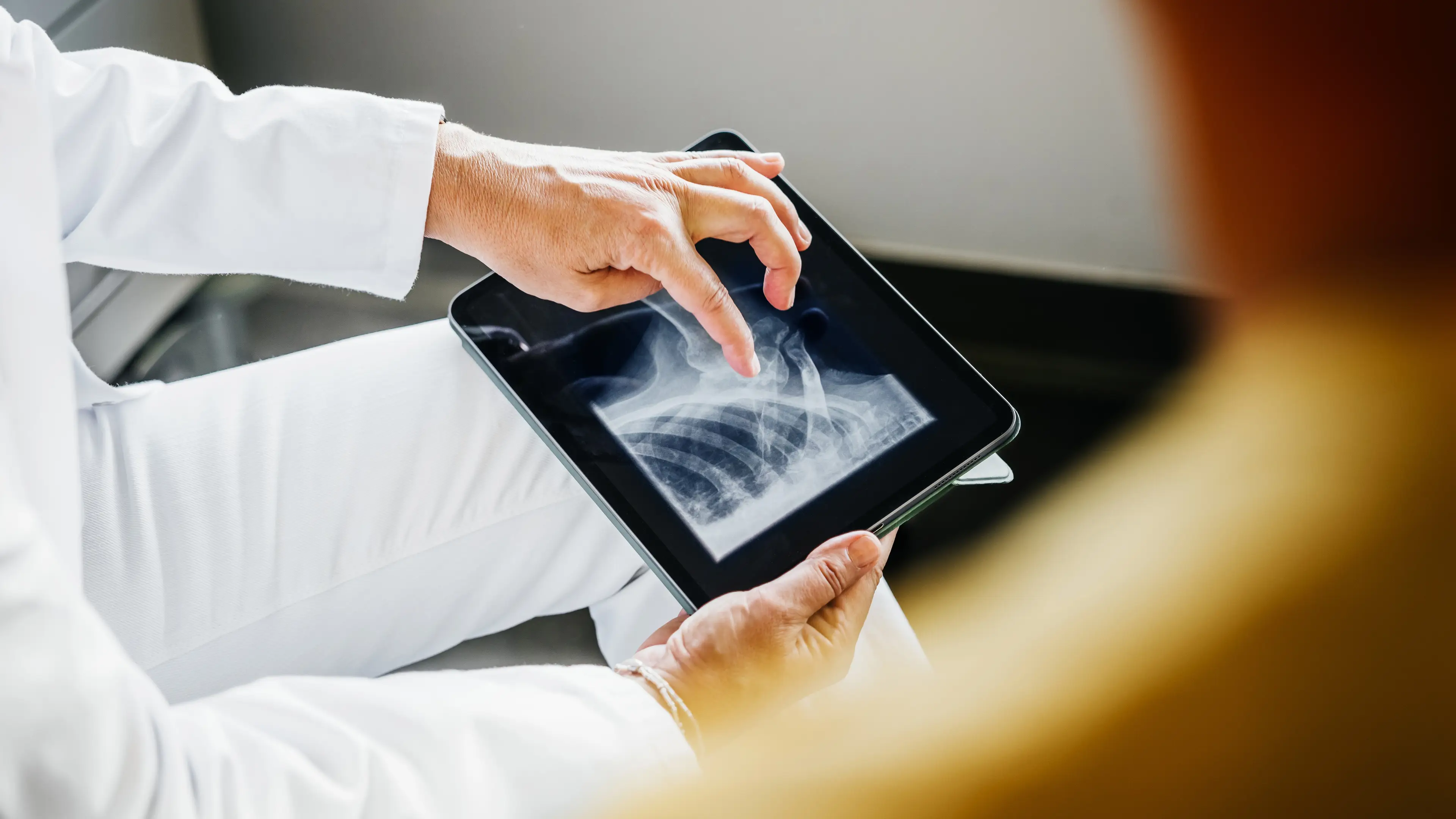 Doctor weighs in on three bizarre theories about people who have 'never broken a bone'