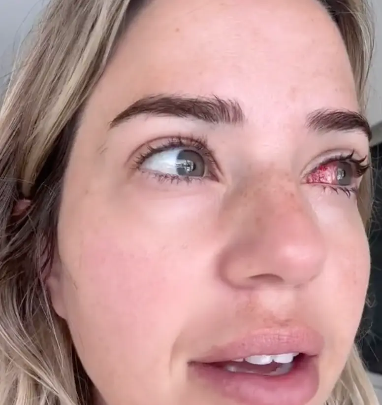 Laura has undergone surgery (TikTok/ @laurac1are)