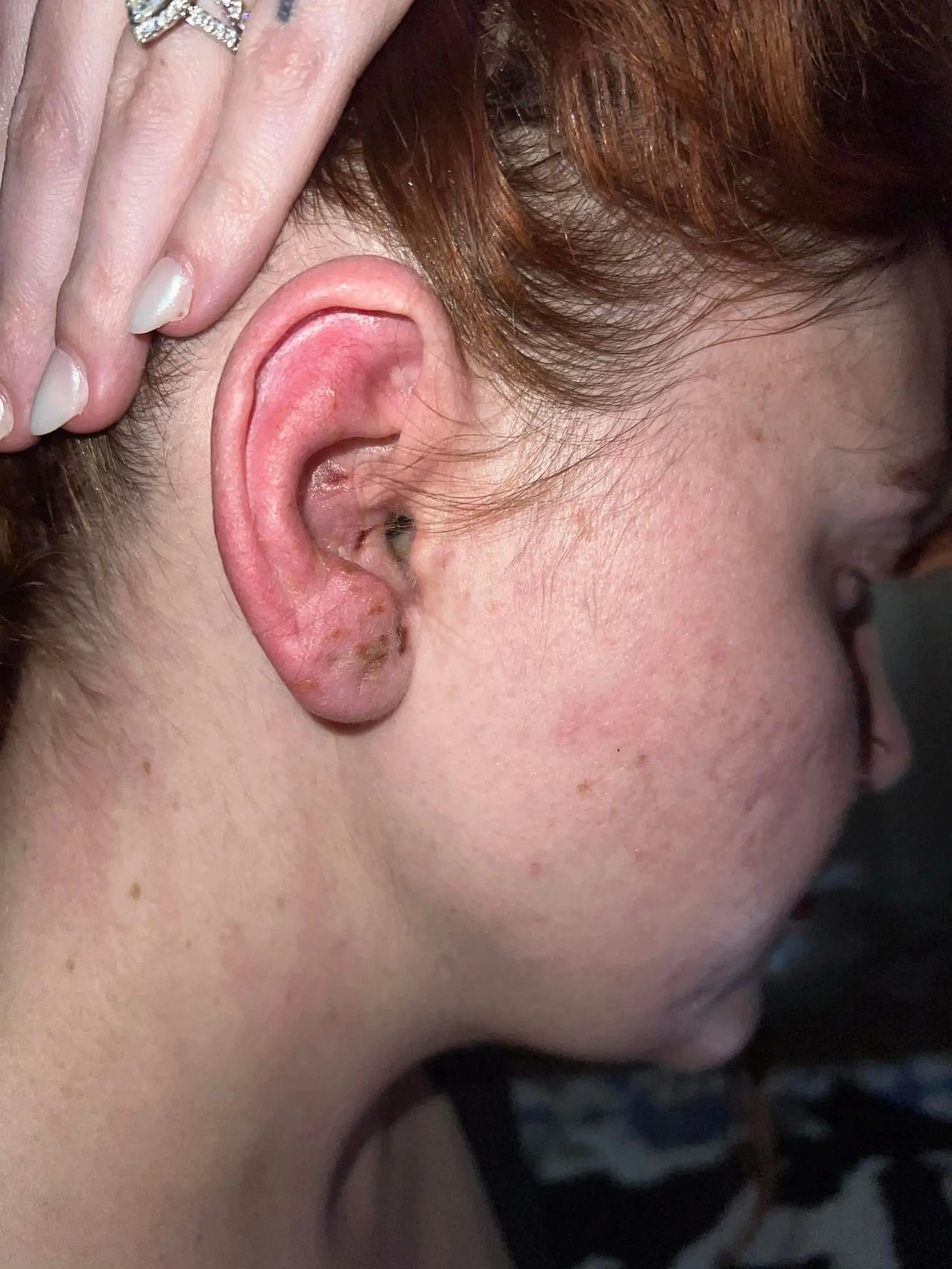 Kelly said she woke up on her wedding morning to a blistered ear (Kennedy News and Media)