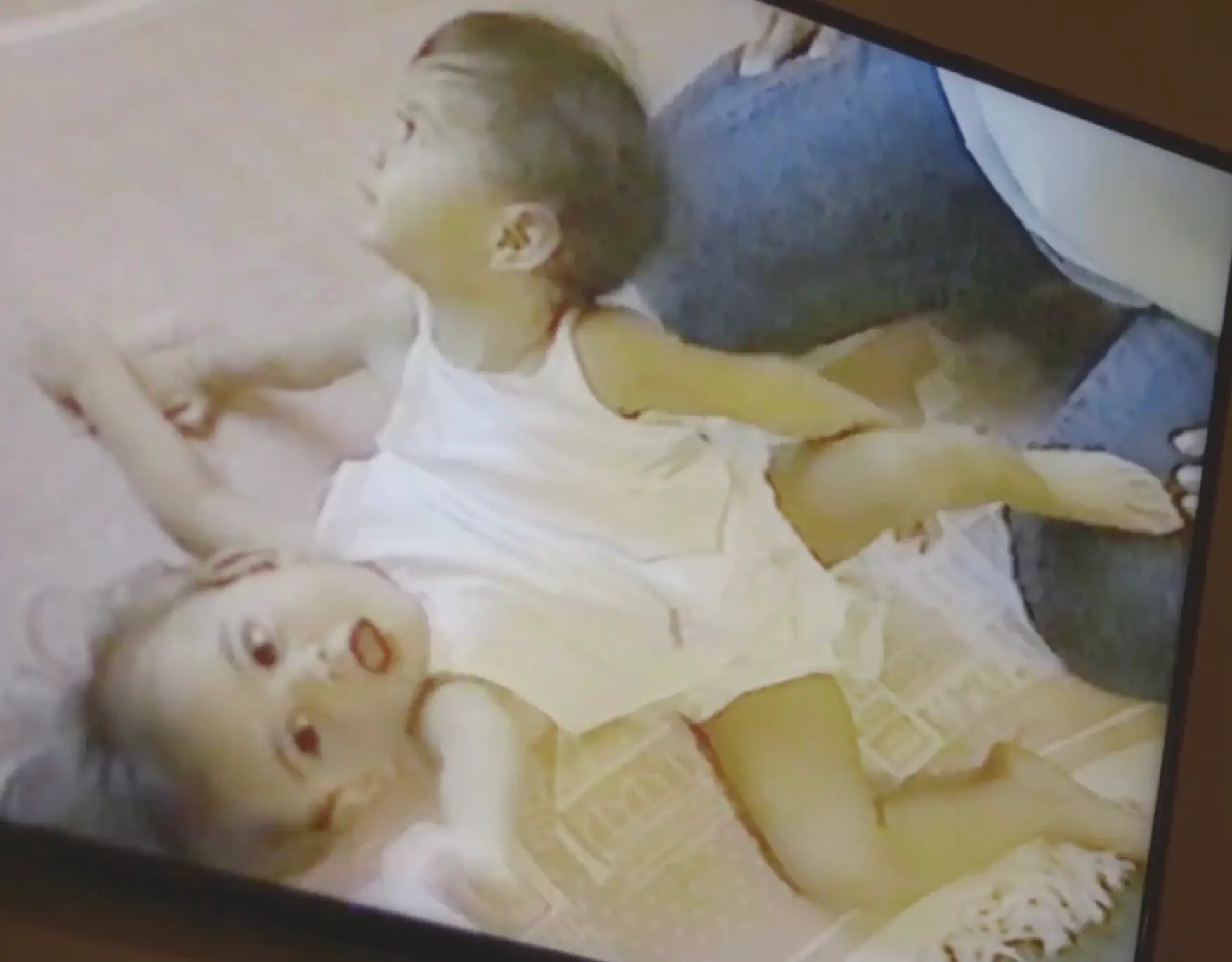 Doctors warned their parents the twins may not live beyond three days. (YouTube/Channel 4 documentaries)