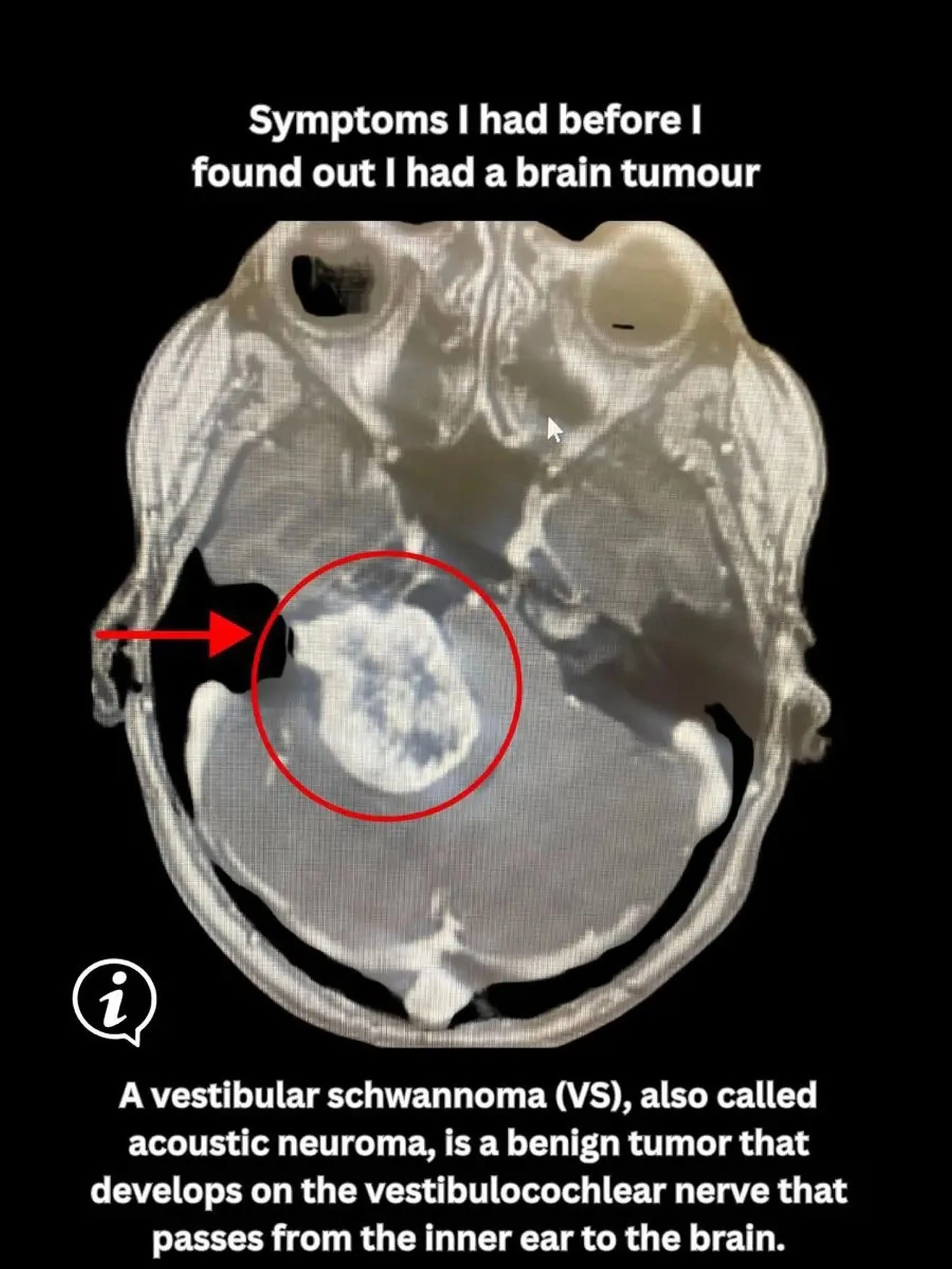 Tamara's tumor wasn't just huge, it was gigantic (Tamara Bright/Kennedy News Media)