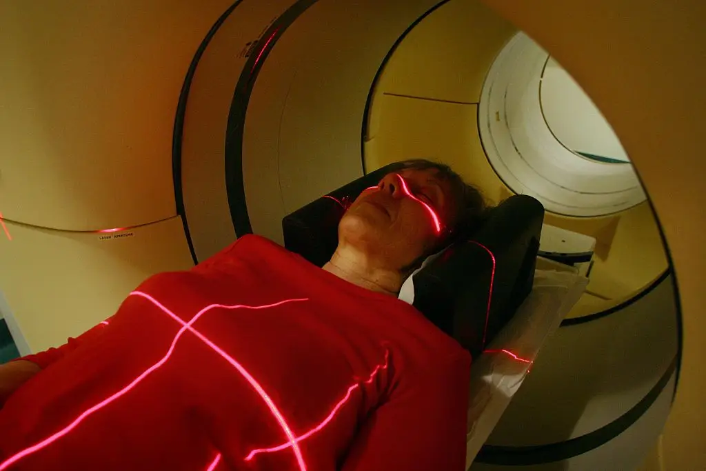 (Fairfax Media via Getty Images/Fairfax Media via Getty Images via Getty Images)