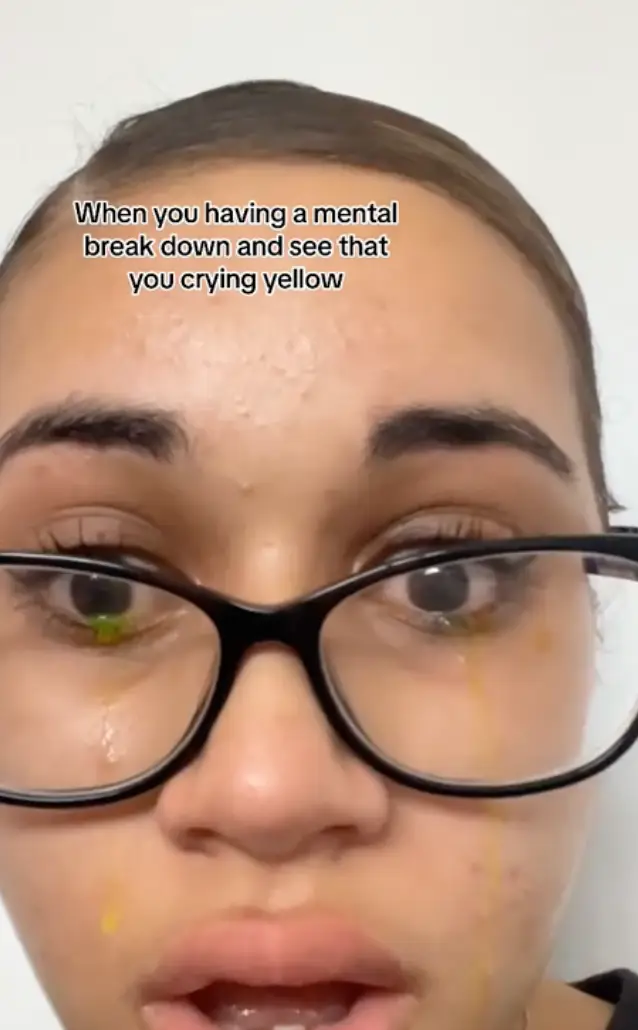 There are several causes. (TikTok)
