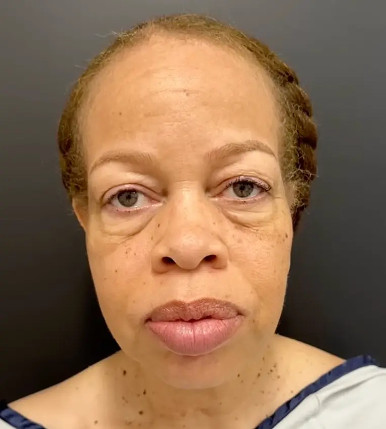 The before picture of the woman, she looks like your typical mom in her 50s (YouTube/@Dr.Truesdale)
