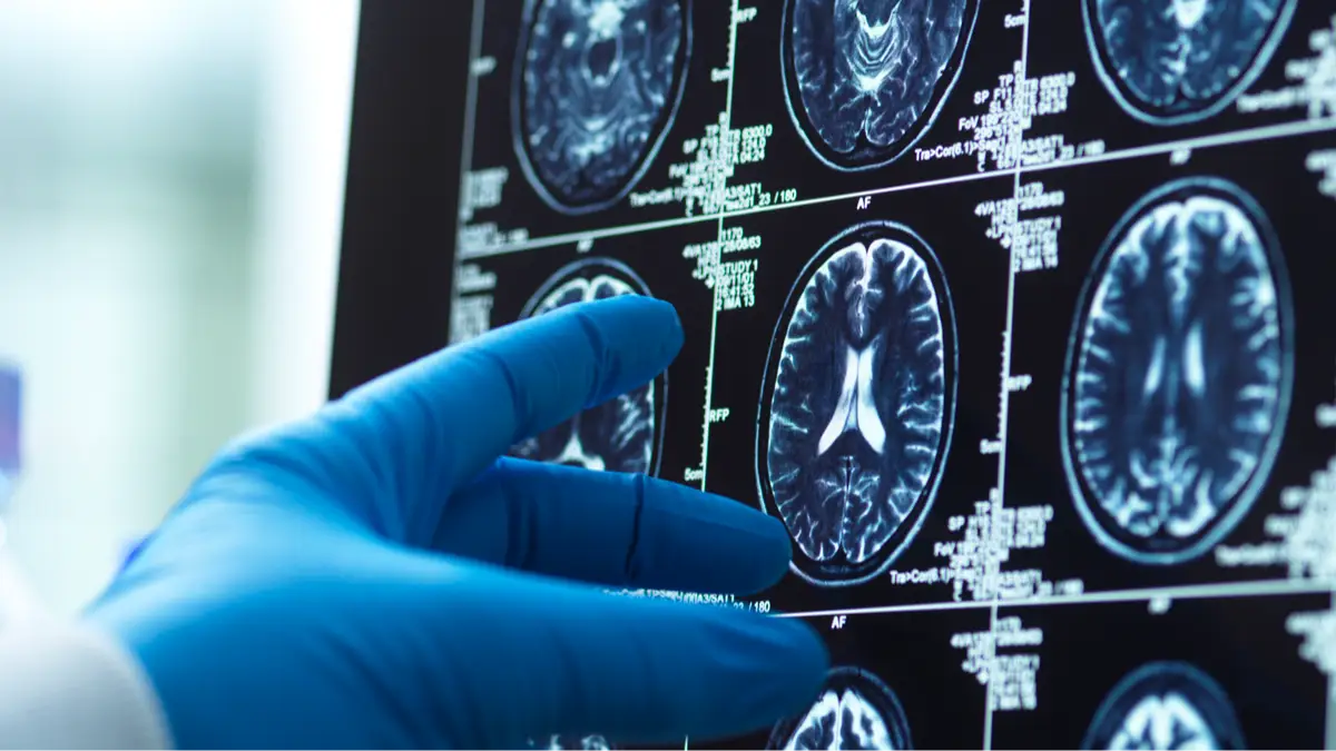 Getty Images/Andrew Brookes