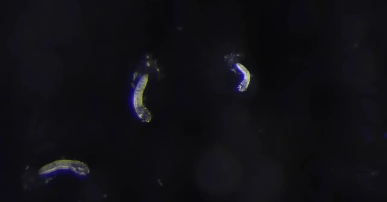 They feast on feast on waxy sebum, the oil your skin naturally produces.