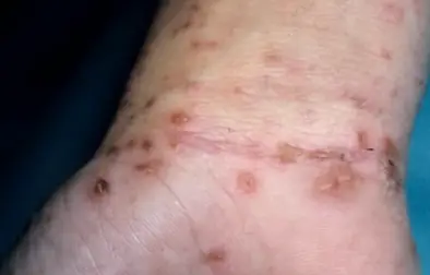 Rushton initially thought she was suffering from an allergic reaction(YouTube/Med Today)