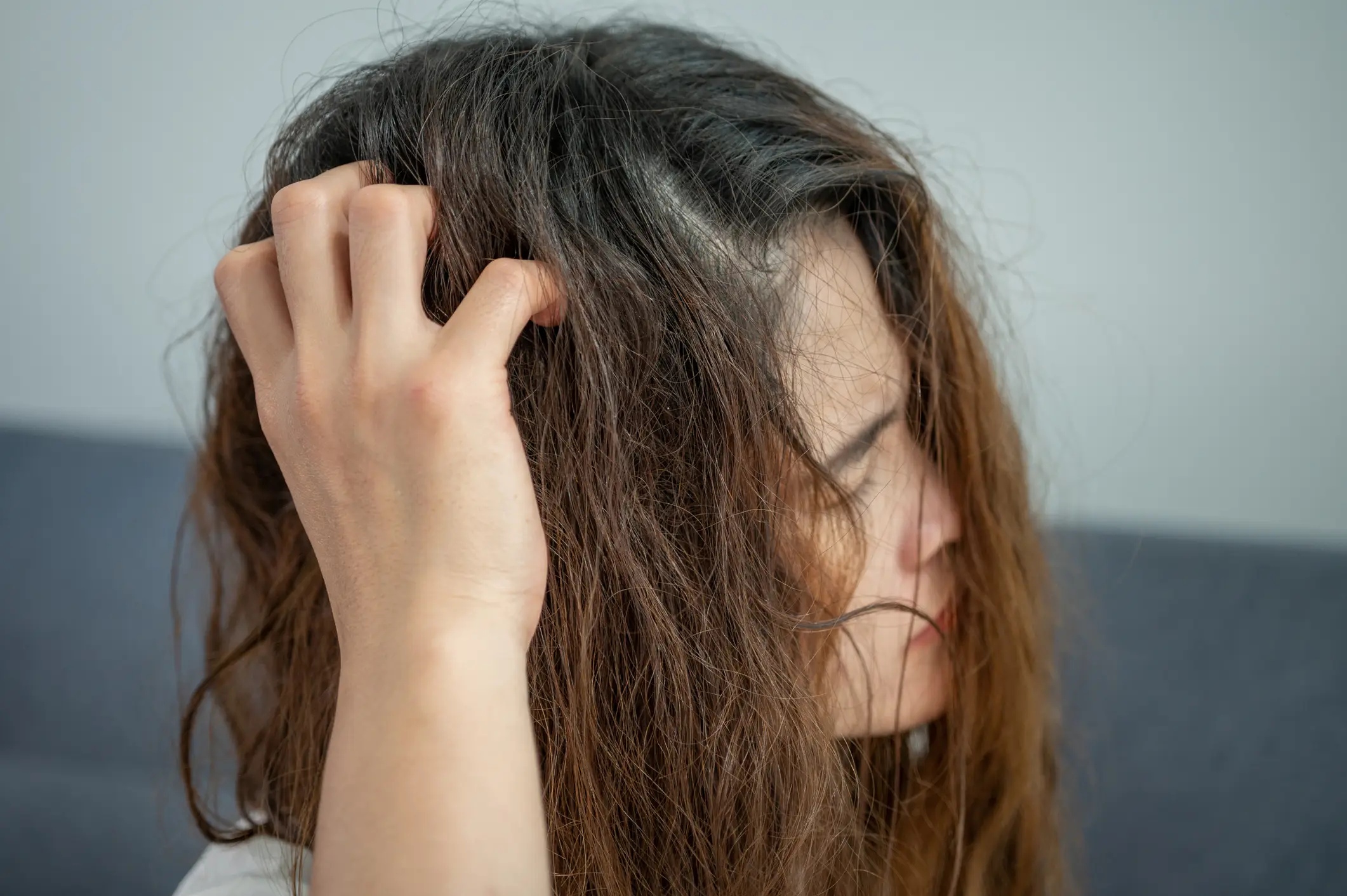 Scalp issues can cause hair loss (Boy_Anupong/Getty Images)