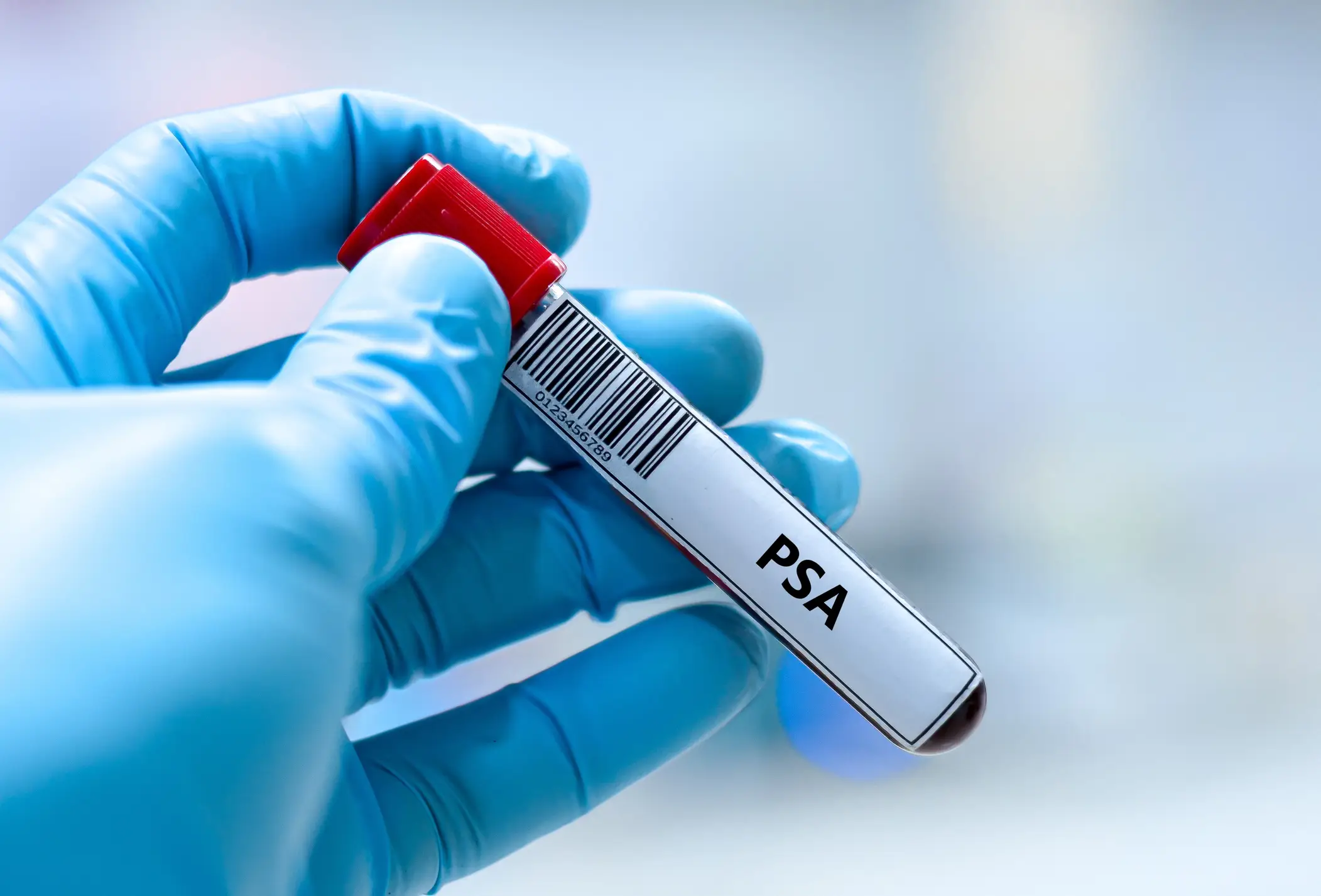 It's no wise to skip your PSA screenings (Kitsawet Saethao/Getty Images)