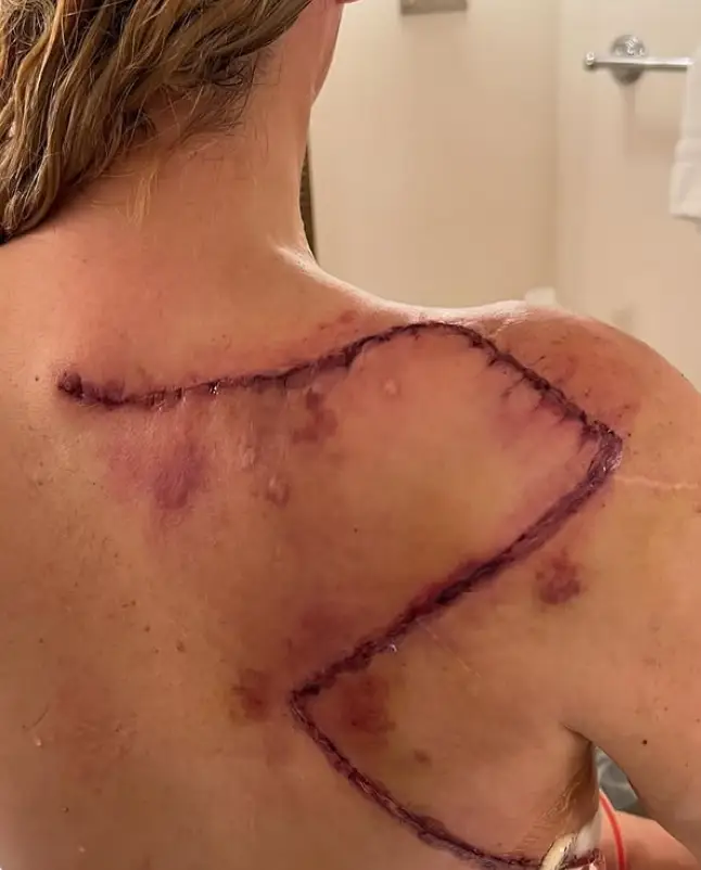 Teddi Mellencamp underwent numerous surgeries for a terrible disease (Instagram/@teddimellencamp)