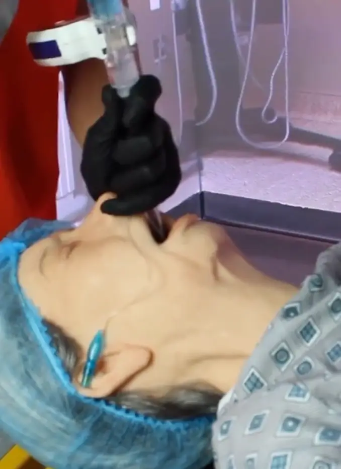 A TikTok account showed what it looks like when you undergo surgery (TikTok/Echo_Healthcare)