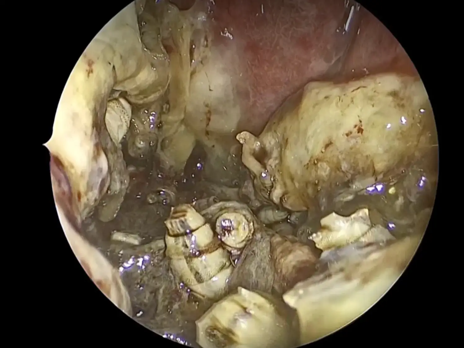 The inside of his nose is as grim as you are thinking.